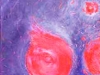 03_Detail_Feuerindenfeldern07
