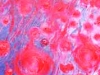 05_Feuerindenfeldern09